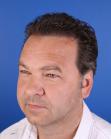 After Hair Transplant&nbsp;Temporal Hairline